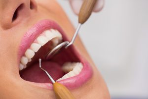 periodoncia dental Bailén