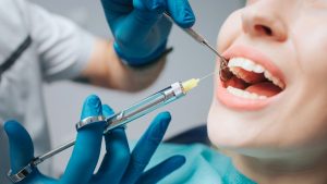 Anestesia Local en Odontología